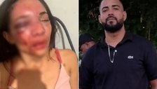 Jovem de Wall Ferraz é brutalmente agredida pelo companheiro em Picos