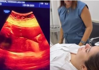 Maquiadora confunde gravidez de 8 meses com gases e viraliza
