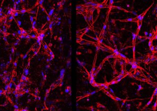 Cientistas criam células da retina em laboratório para tratar cegueira