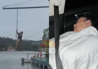 Mulher sofre grave lesão durante passeio em cruzeiro e acumula despesas médicas de R$ 270 mil