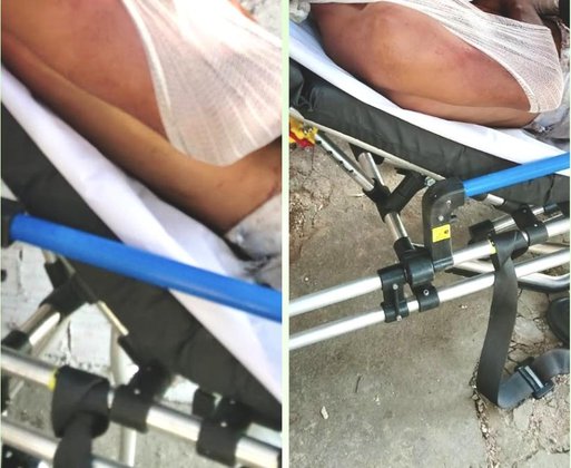 Homem é agredido com pedrada na cabeça após ter casa invadida